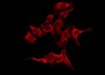 OR51B5 Antibody