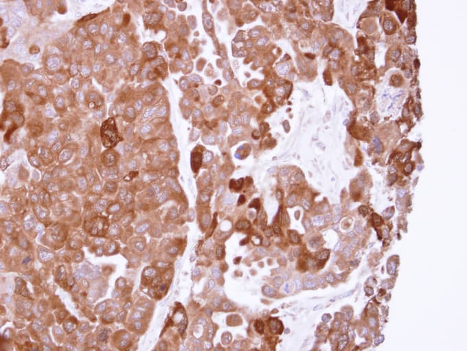 PPA1 Antibody (aa1-289)
