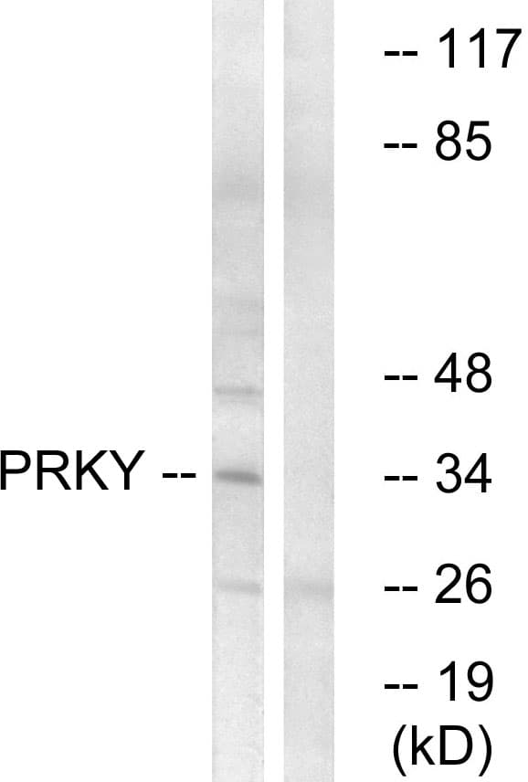 Polyclonal Rabbit anti-Human PRKY Antibody (WB)