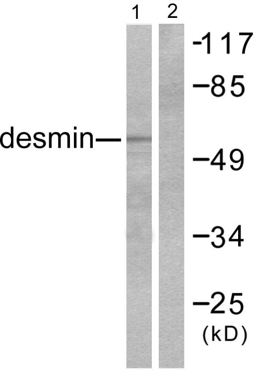 DES / Desmin Antibody