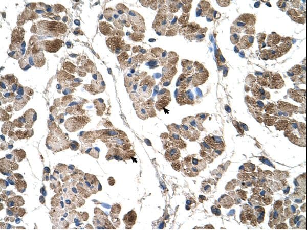 ACTN2 Antibody (C-Terminus, HRP)