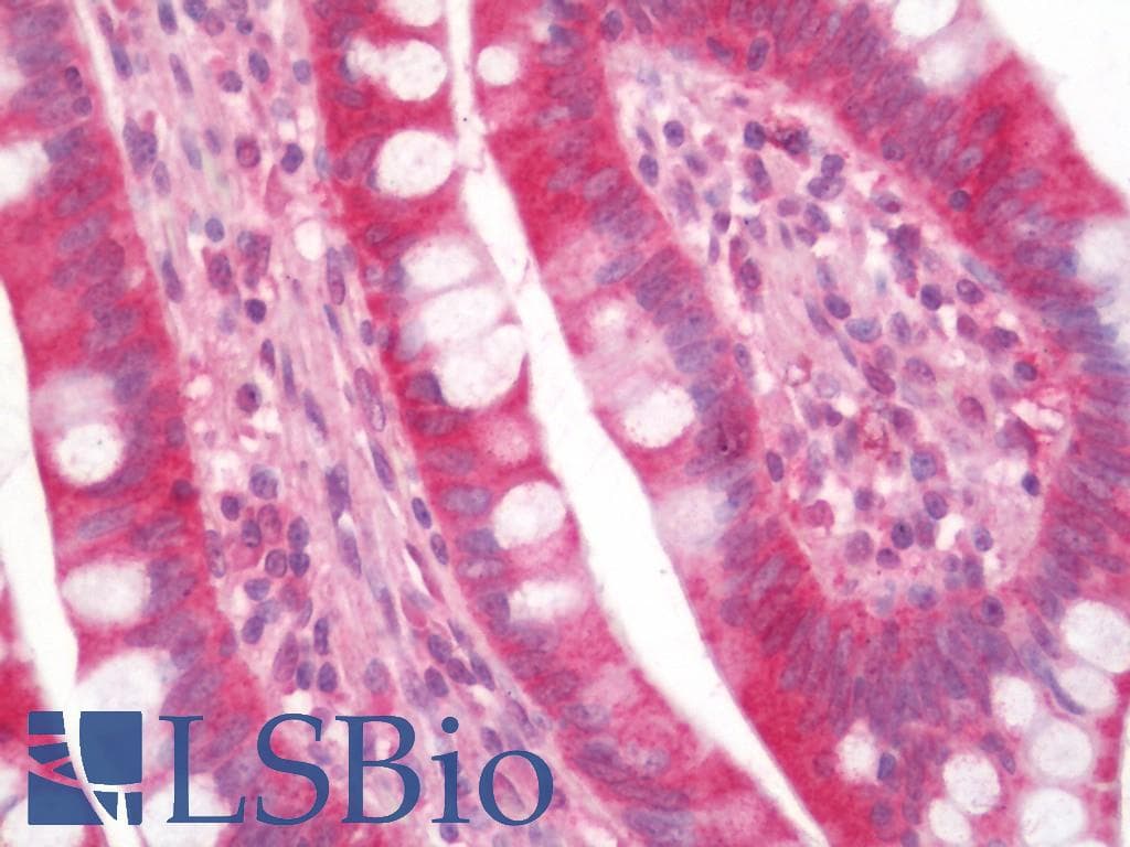 IHC-plus™ Polyclonal Rabbit anti-Human TIGAR Antibody (aa220-270, IHC)