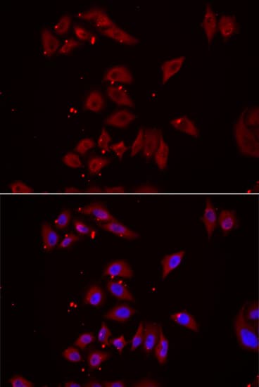 NPHP1 / Nephronophthisis Antibody (aa463-732)