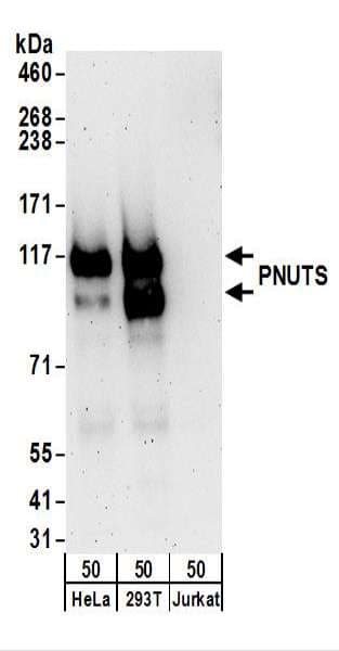 IHC-plus™ PPP1R10 / PNUTS Antibody (aa350-400)