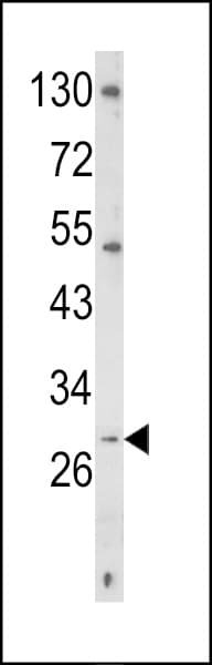 Polyclonal Rabbit anti-Human CD40L Antibody (aa181-207, IHC, WB)