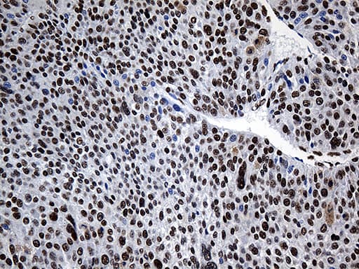 HNRNPH1 / hnRNP H Antibody (clone OTI5D11)
