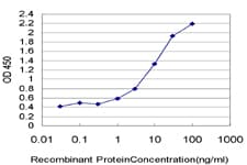 KDM5B / JARID1B Antibody (clone 1G10)
