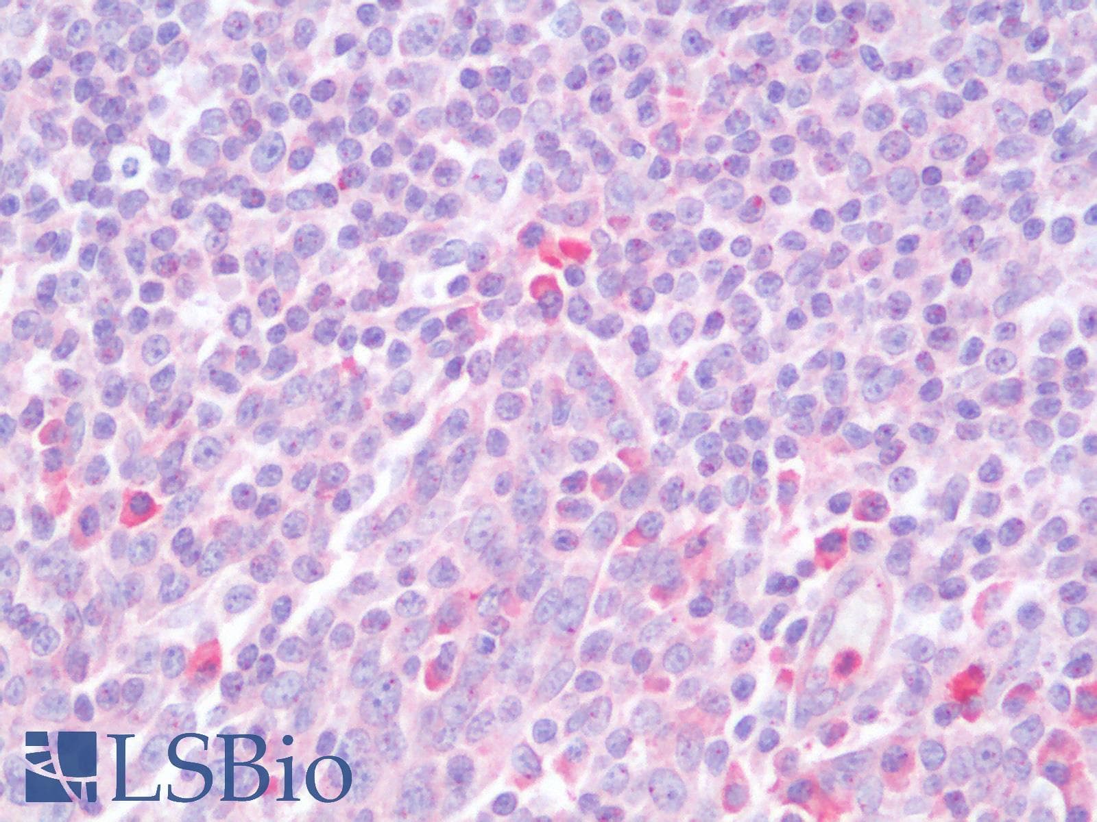 PathPlus™ Polyclonal Rabbit anti-Human CD274 / B7-H1 / PD-L1 Antibody (IHC)
