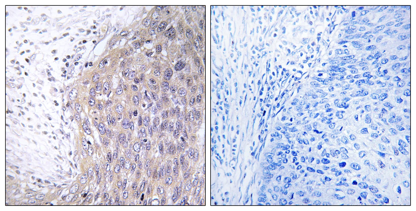 Polyclonal Rabbit anti-Human POLG2 Antibody (aa291-340, IHC)