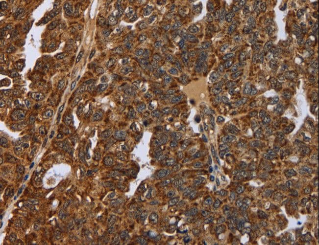 NEFH / NF-H Antibody
