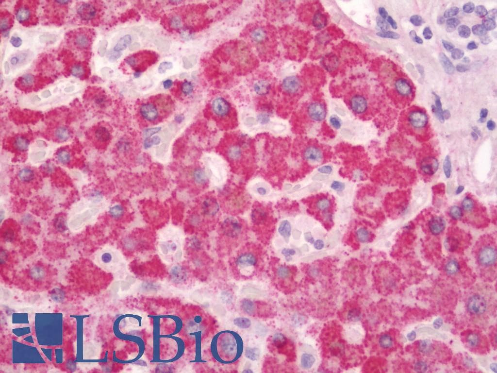 IHC-plus™ Polyclonal Rabbit anti-Human LPGAT1 Antibody (aa49-198, IHC, WB)