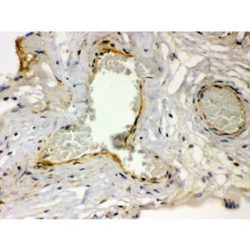 Polyclonal Rabbit anti-Human F2R / Thrombin Receptor / PAR1 Antibody (aa46-82, IHC, WB)