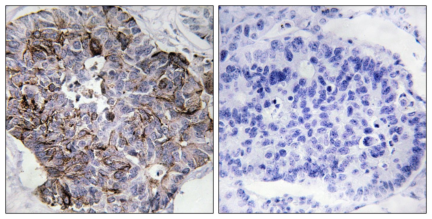 MRLC2 / MYL12B Antibody (p18)