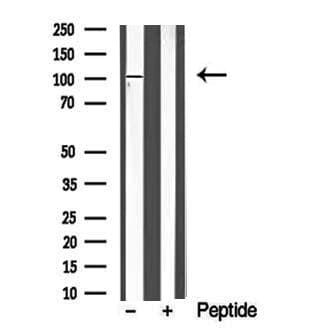 Polyclonal Rabbit anti-Human PKN1 Antibody (WB)