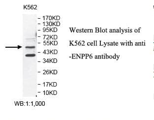 ENPP6 Antibody (aa25-195)