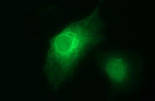 HPRT1 / HPRT Antibody (clone OTI1B1)