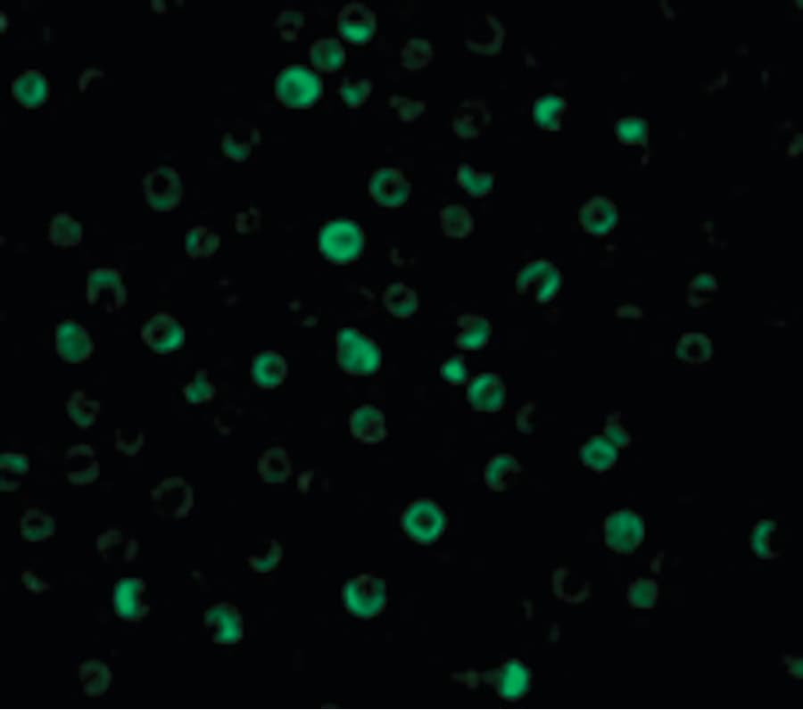 IHC-plus™ IL22RA1 / IL22R Antibody
