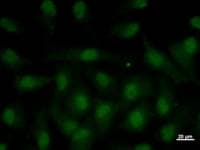 Monoclonal Mouse anti-Human NR4A1 / NUR77 Antibody (clone NR4AB9G12, IF, WB)