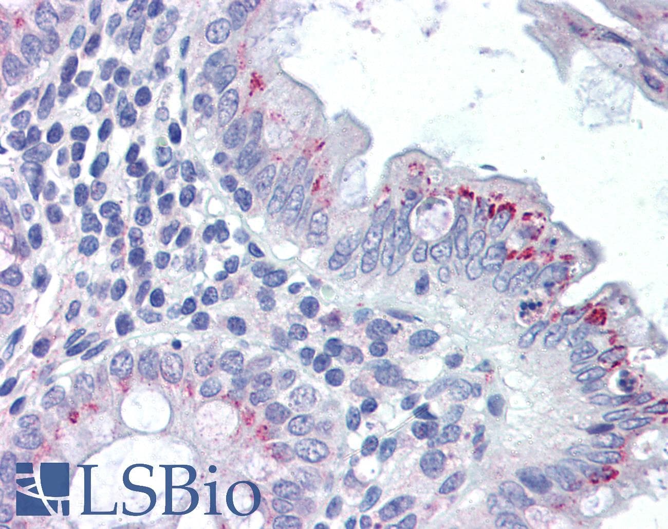 IHC-plus™ Polyclonal Rabbit anti-Human FPR2 / FPRL1 Antibody (C-Terminus, IHC, IF, WB)