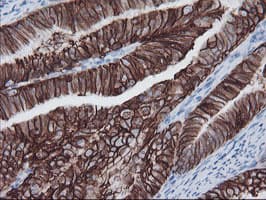 FXYD3 Antibody (clone OTI1F12)