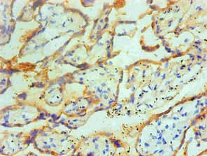 TGM2 / Transglutaminase 2 Antibody (clone 3H2B8)