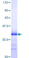 Human ZBTB16 / PLZF Protein (Recombinant GST, N-terminus)