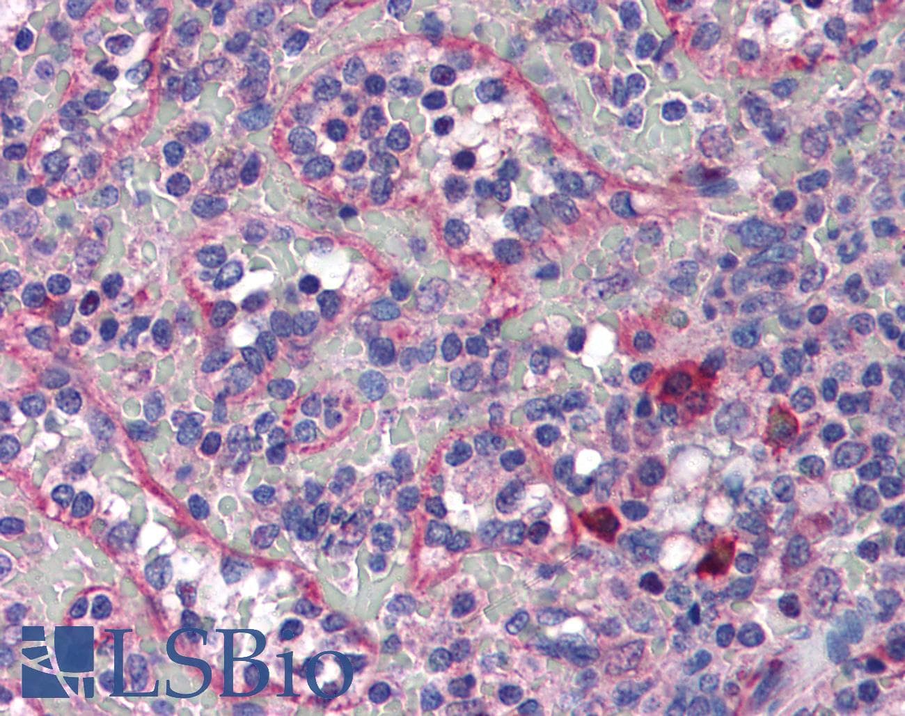 IHC-plus™ COPB2 / Beta-COP Antibody (aa494-511)