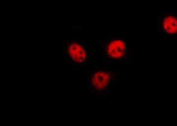 MAPK8 / JNK1 Antibody (phospho-Thr183)