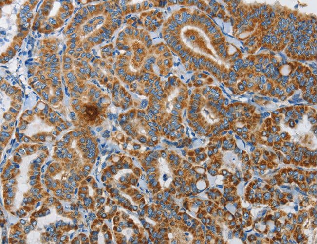 Polyclonal Rabbit anti-Human RENT1 / UPF1 Antibody (IHC, WB)