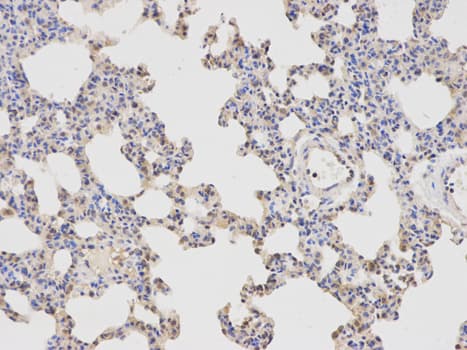 APBB1 / FE65 Antibody