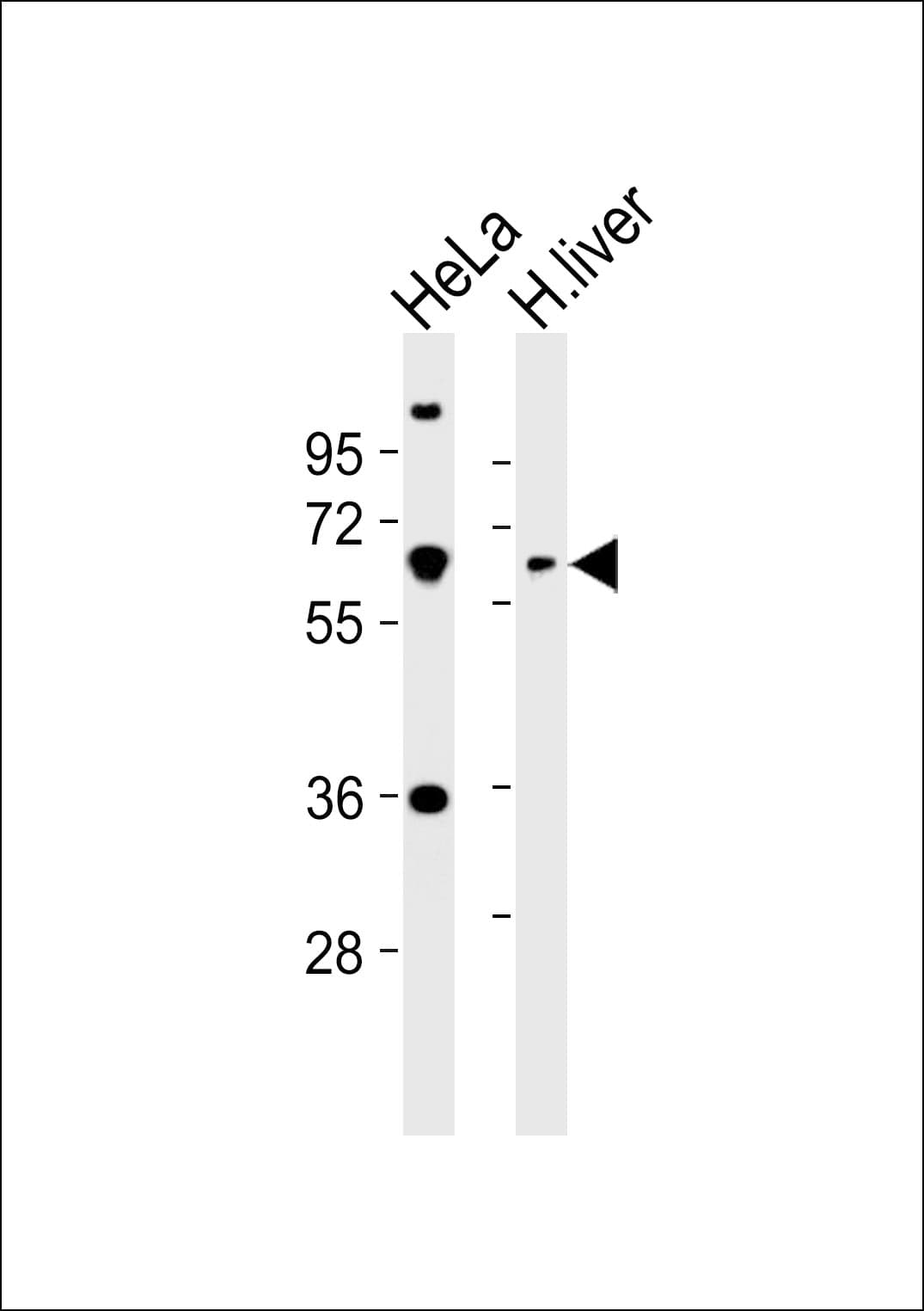 Polyclonal Rabbit anti-Human PPP2R1B Antibody (WB)