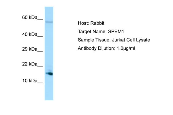 SPEM1 Antibody (aa72-121)