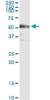 Monoclonal Mouse anti-Human IRF3 Antibody (clone 3C8, IF, WB)