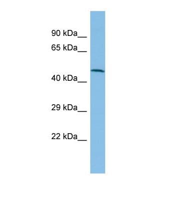 FOLH1 / PSMA Antibody (aa198-247)