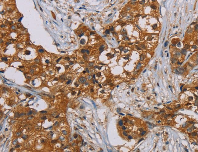 PSMC2 / RPT1 Antibody