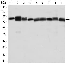 IHC-plus™ HSP90AB1 / HSP90 Alpha B1 Antibody (aa149-357, clone 1D9)