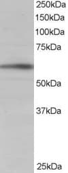IHC-plus™ Polyclonal Goat anti-Human BAIAP2 / IRSP53 Antibody (Isoform 1, IHC, WB)
