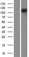 TCHHL1 Protein (Over-Expression Lysate Myc-DDK (Flag))
