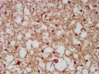 Polyclonal Rabbit anti-Human CUX1 / CASP Antibody (IHC, WB)