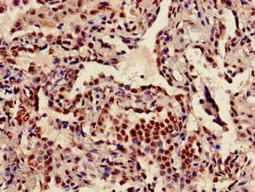 HIST1H3A Antibody