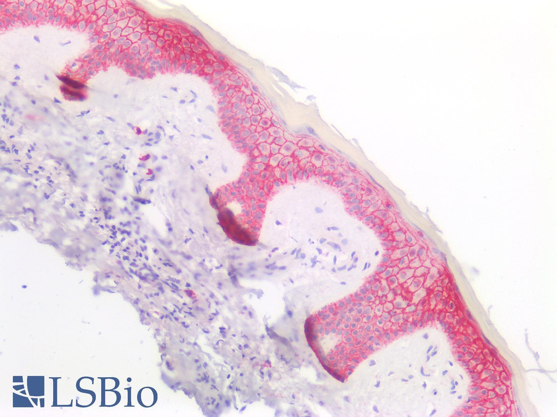 IHC-plus™ SDC1 / Syndecan 1 / CD138 Antibody (aa25-240)