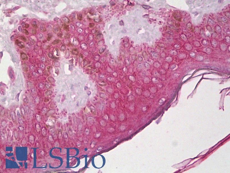IHC-plus™ CXCR4 Antibody (N-Terminus)