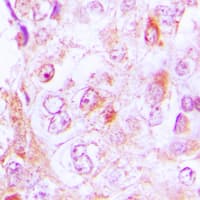 COL6A2 / Collagen VI Alpha 2 Antibody (Internal)