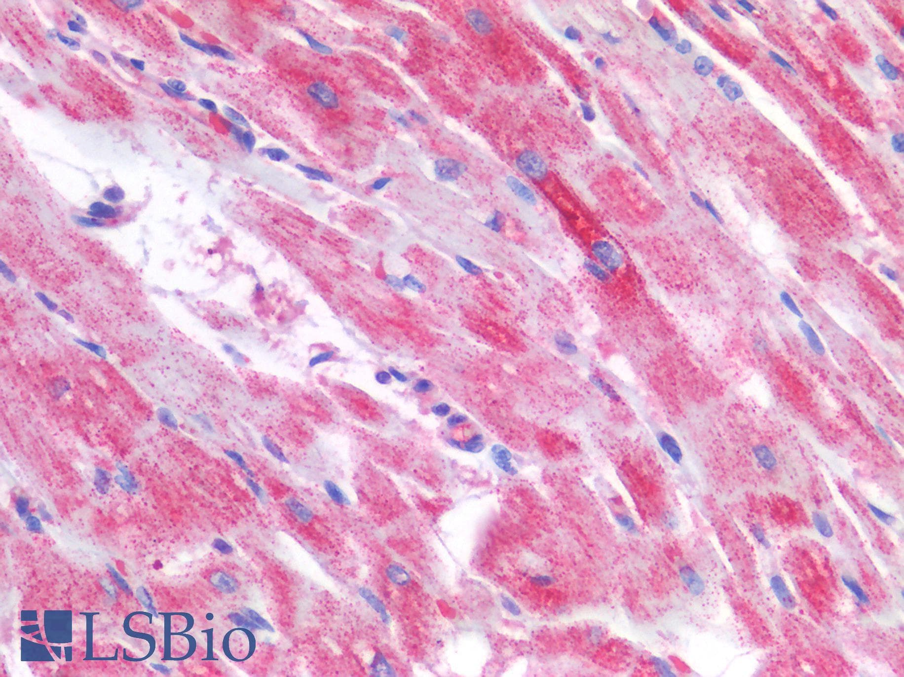 IHC-plus™ Polyclonal Rabbit anti-Human TP53 / p53 Antibody (IHC)