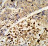 Polyclonal Rabbit anti-Human NR1I2 / PXR Antibody (aa100-127, IHC, IF, WB)