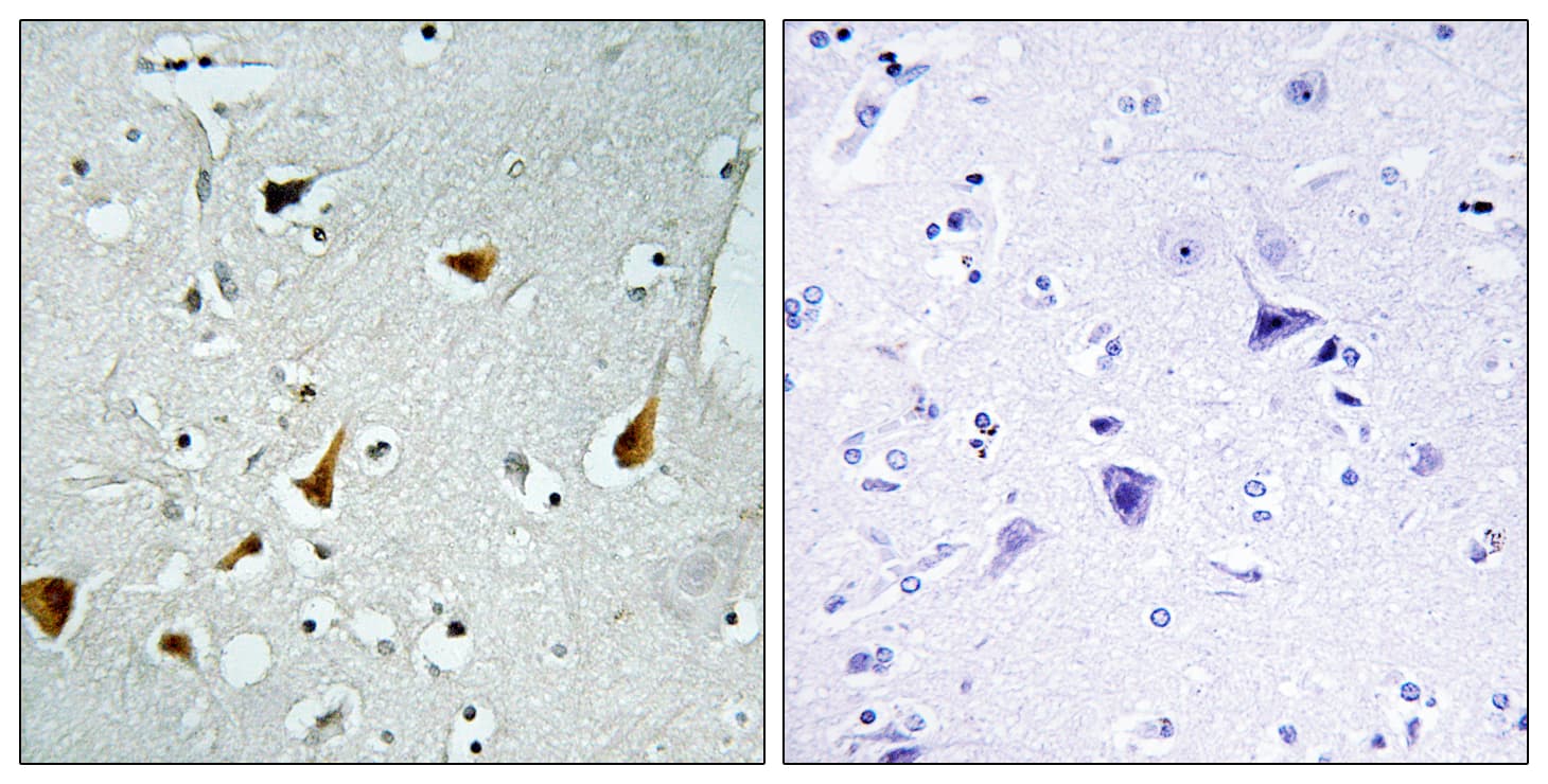 Polyclonal Rabbit anti-Human STAT6 Antibody (aa608-657, IHC, WB)