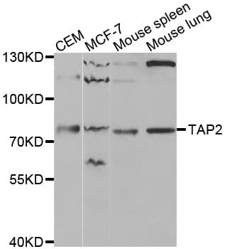 IHC-plus™ Polyclonal Rabbit anti-Human TAP2 Antibody (IHC, IF, WB)