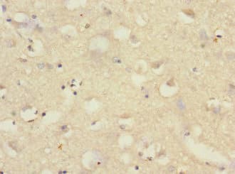 SAE1 Antibody