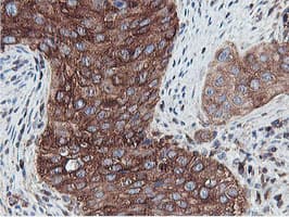PFKP Antibody (clone OTI5F7)