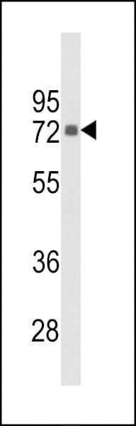 Polyclonal Rabbit anti-Human PIP5K1C Antibody (aa637-668, IHC, WB)